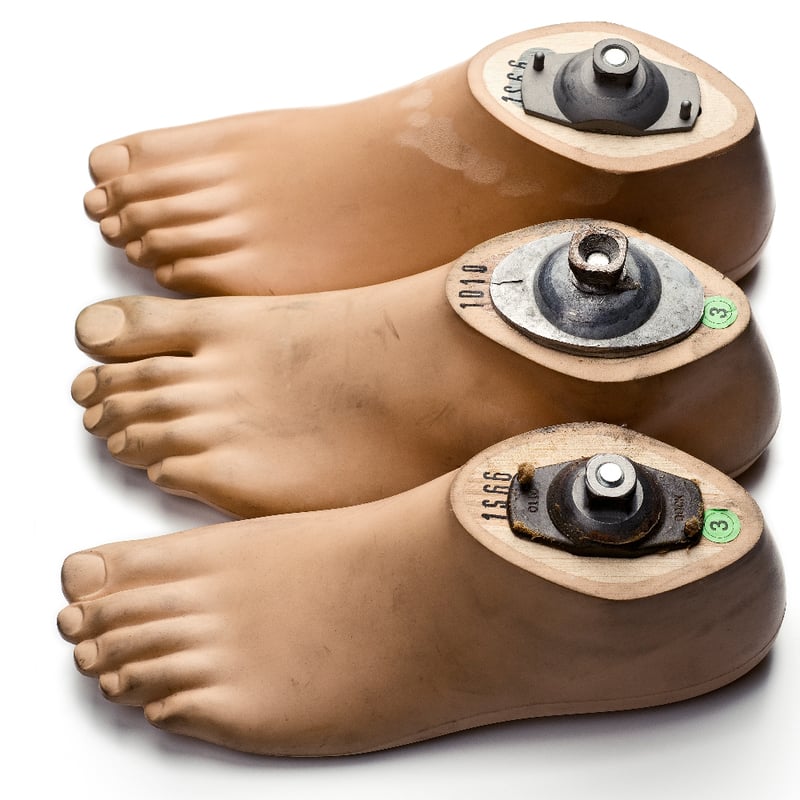 content_prosthetic_foot-body